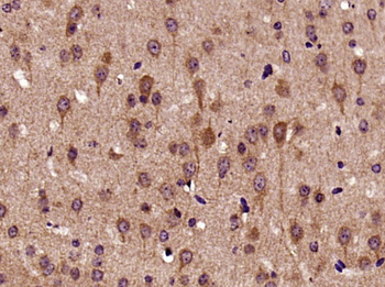 Biglycan Rabbit Polyclonal Antibody