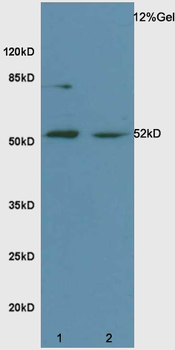 Biglycan Rabbit Polyclonal Antibody