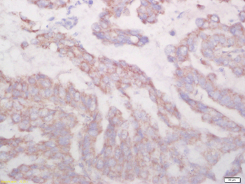 Biglycan Rabbit Polyclonal Antibody