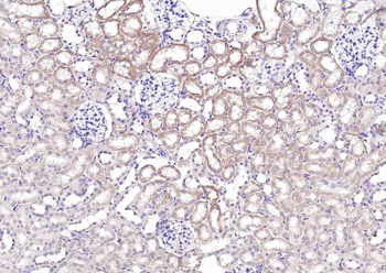 Phospho-TIRAP (Tyr86) Rabbit Polyclonal Antibody