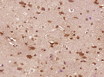 BCL2L15 Rabbit Polyclonal Antibody