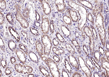 Adenylosuccinate Lyase Rabbit Polyclonal Antibody