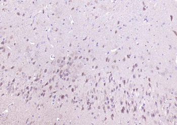 Adenylosuccinate Lyase Rabbit Polyclonal Antibody