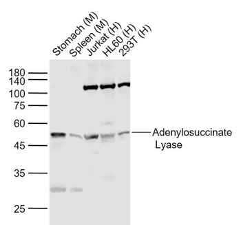 Adenylosuccinate Lyase Rabbit Polyclonal Antibody