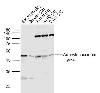 Adenylosuccinate Lyase antibody