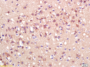 ADAMTS7 Rabbit Polyclonal Antibody