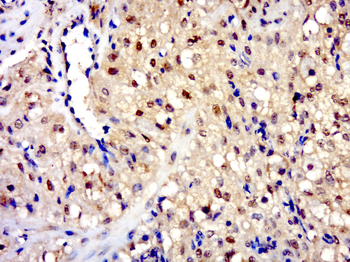 ZNF420 Rabbit Polyclonal Antibody