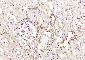 PTK5/FRK Rabbit Polyclonal Antibody