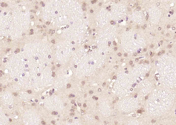 PCNP Rabbit Polyclonal Antibody