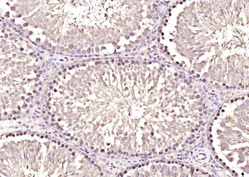 TP53TG5 Rabbit Polyclonal Antibody