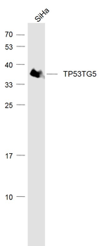 TP53TG5 Rabbit Polyclonal Antibody