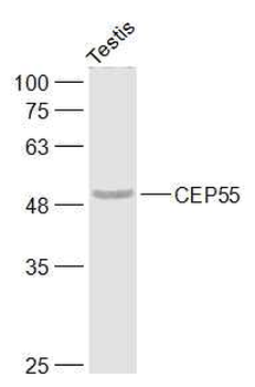 CEP55 Rabbit Polyclonal Antibody