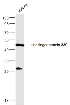 ZNF830 Rabbit Polyclonal Antibody