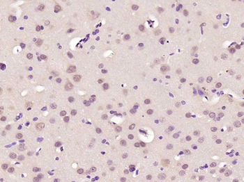 PPHLN1 Rabbit Polyclonal Antibody