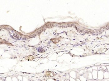 PPHLN1 Rabbit Polyclonal Antibody