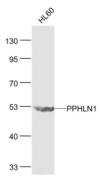 PPHLN1 Rabbit Polyclonal Antibody