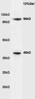Cyclin M2 Rabbit Polyclonal Antibody