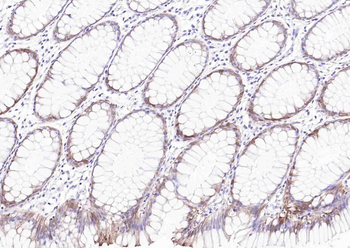 Adiponectin receptor 2 Rabbit Polyclonal Antibody