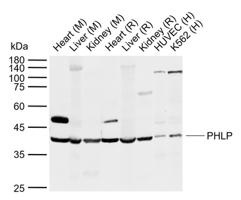 PHLP Rabbit Polyclonal Antibody