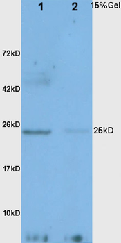 Adiponectin Rabbit Polyclonal Antibody