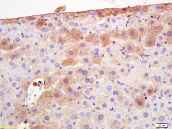 Adiponectin Rabbit Polyclonal Antibody