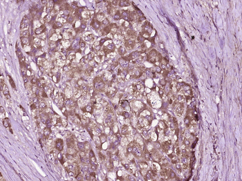 MIIP Rabbit Polyclonal Antibody