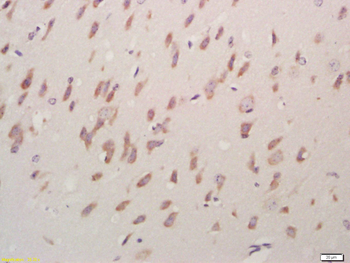 ACCN1 Rabbit Polyclonal Antibody
