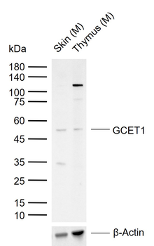 GCET1 Rabbit Polyclonal Antibody