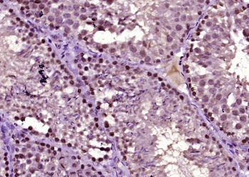 HSP40 Rabbit Polyclonal Antibody