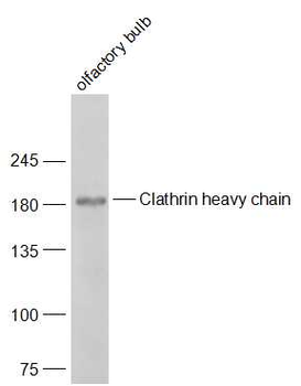 Clathrin heavy chain Rabbit Polyclonal Antibody