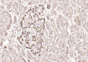 IQCJ Rabbit Polyclonal Antibody