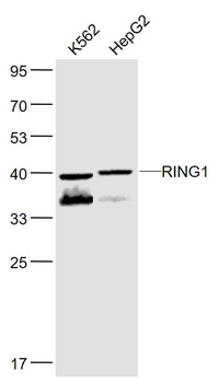 RING1 Rabbit Polyclonal Antibody