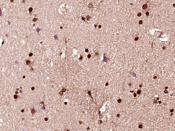 HES1 Rabbit Polyclonal Antibody