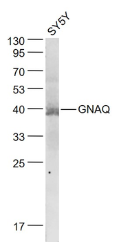 GNAQ Rabbit Polyclonal Antibody