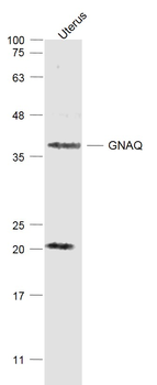 GNAQ Rabbit Polyclonal Antibody