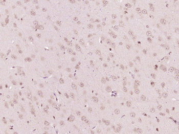 CIKS/TRAF3IP2 Rabbit Polyclonal Antibody