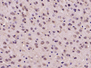 ADNP Rabbit Polyclonal Antibody