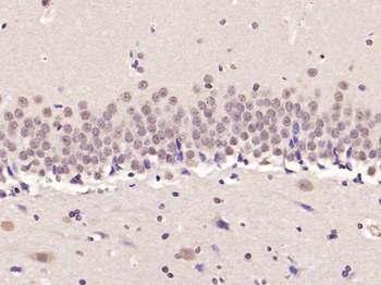 ADNP Rabbit Polyclonal Antibody