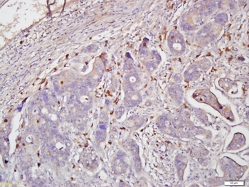 Testin Rabbit Polyclonal Antibody