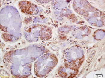 CKMT Rabbit Polyclonal Antibody