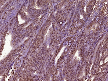 Epithelial Stromal Interaction 1 Rabbit Polyclonal Antibody