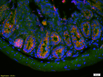PAI1 Rabbit Polyclonal Antibody