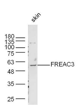 FREAC3 Rabbit Polyclonal Antibody