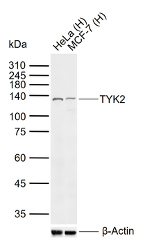 TYK2 Rabbit Polyclonal Antibody
