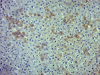 ADRB2 Rabbit Polyclonal Antibody