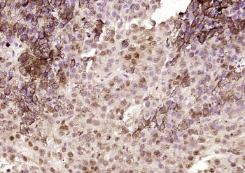 SPANX Rabbit Polyclonal Antibody