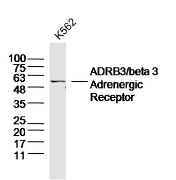 ADRB3 Rabbit Polyclonal Antibody
