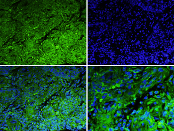 MSR1 Rabbit Polyclonal Antibody