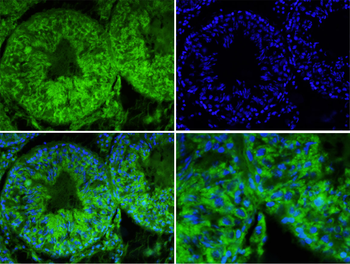 MSR1 Rabbit Polyclonal Antibody