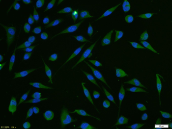 CARD14 Rabbit Polyclonal Antibody